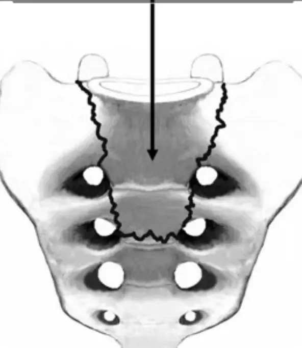 Gathering Moss - July 2025